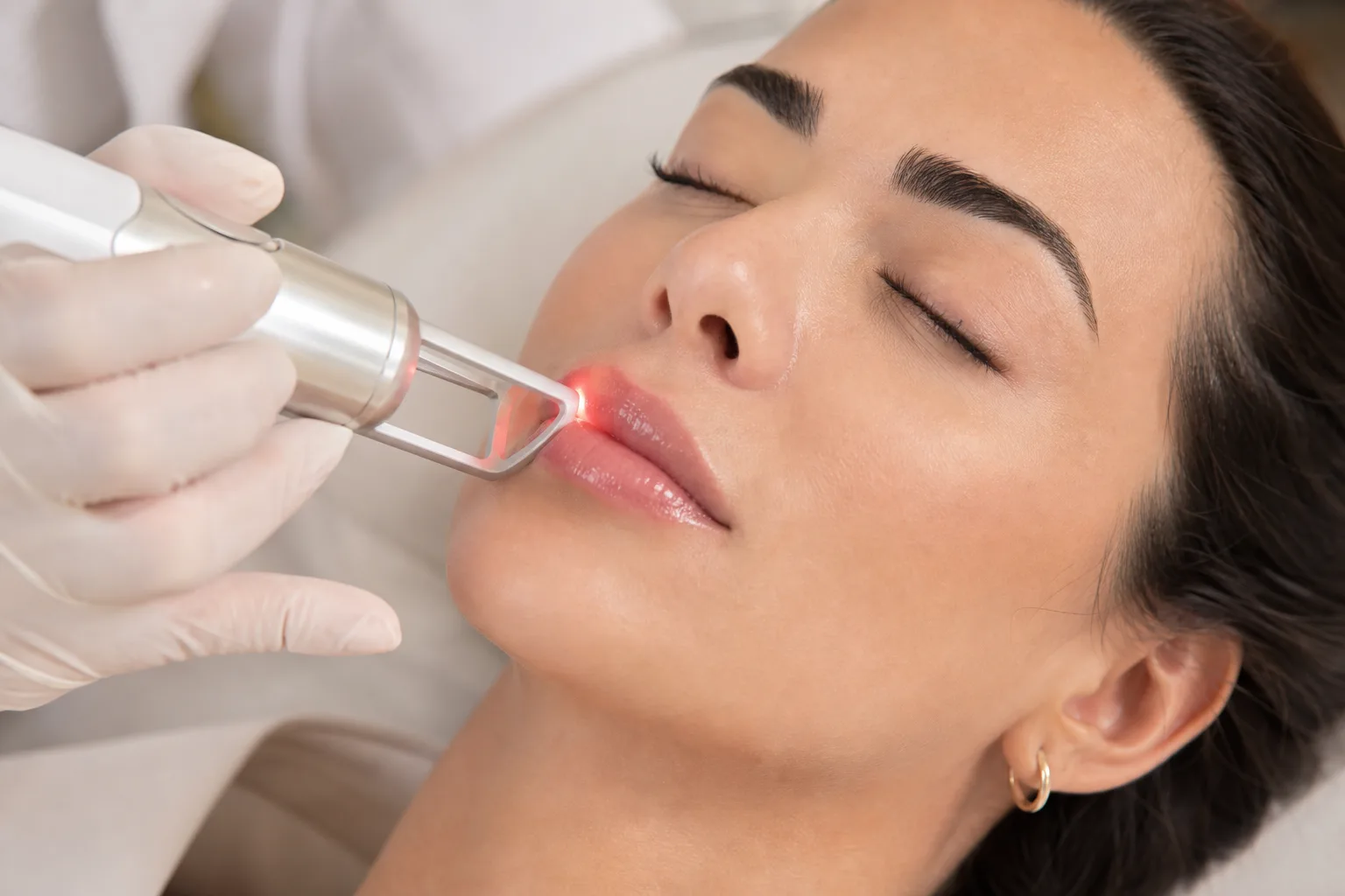 Laser de Volumização Labial + Hidragloss