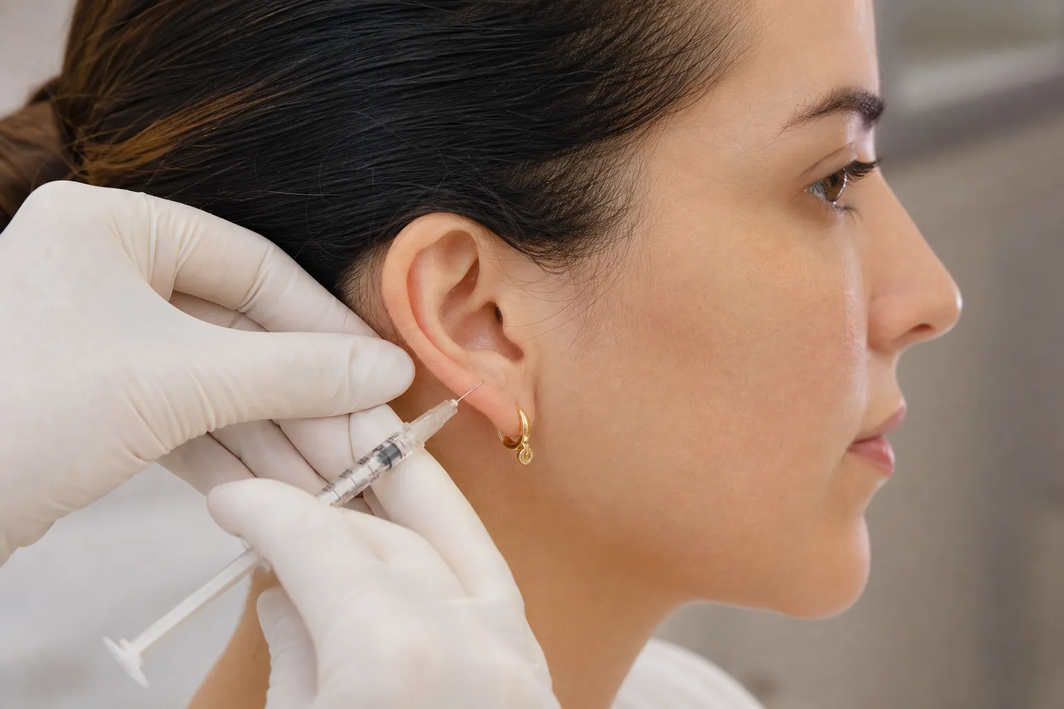 Lobuloplastia sem Corte — procedimento e aplicação