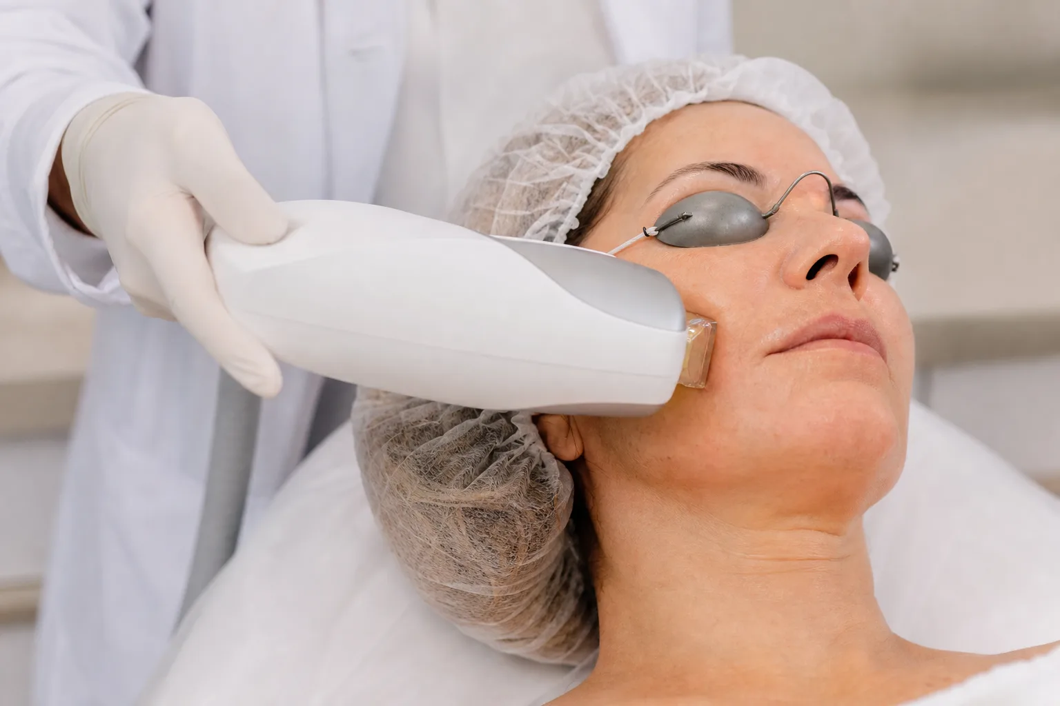 Luz Intensa Pulsada – LIP — procedimento e aplicação