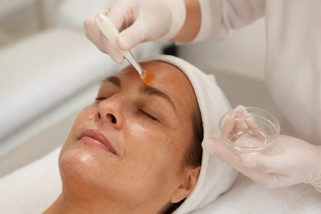 Peeling do Mar Morto