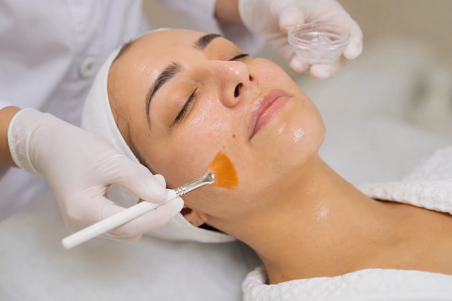 Peeling Químico
